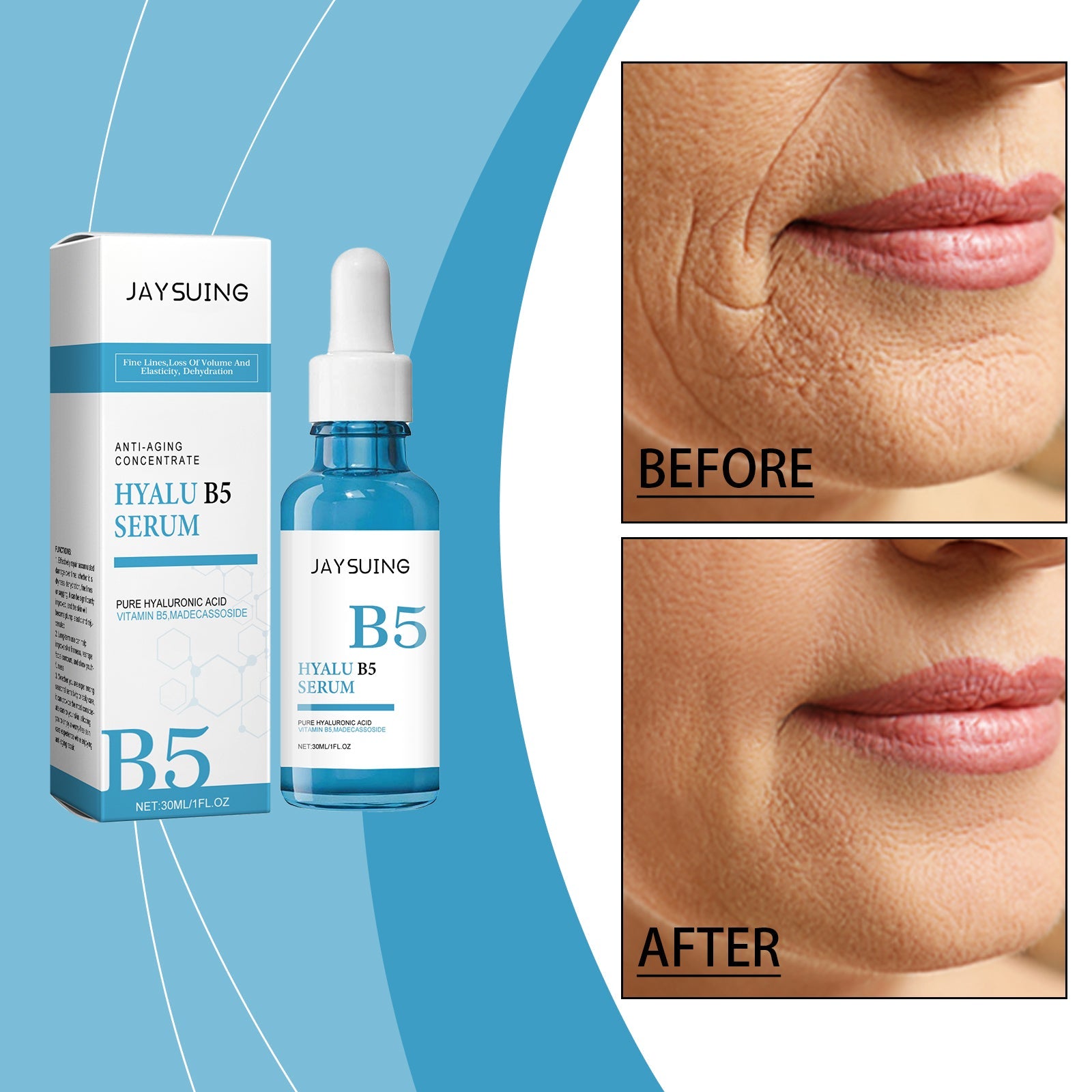 Hyalu B5 Anti-Aging Serum