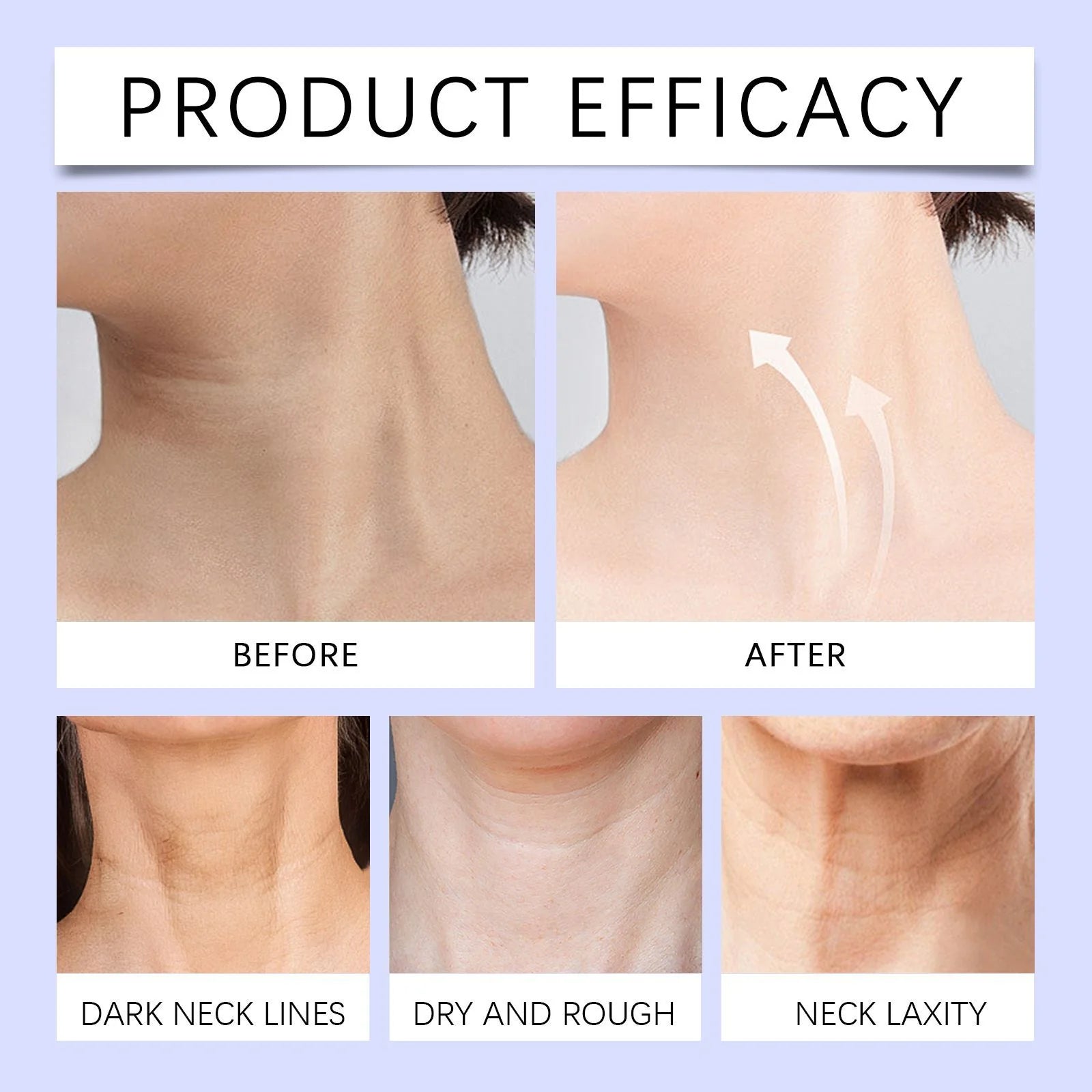 NeckLift Pro Cream